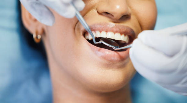 Best Emergency Wisdom Teeth Removal in Glen Lyon, PA